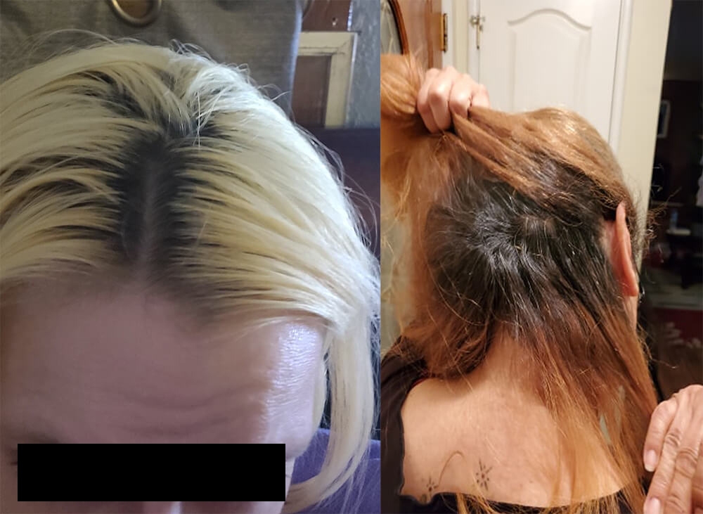 How Long to Leave Bleach in Hair Before Dying It Blue - wide 10