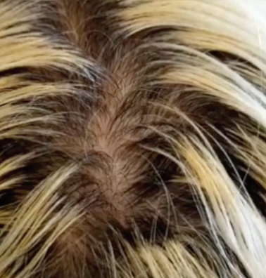 Dark Regrowth & Brassy Roots Need Lifting Dark Regrowth & Brassy Roots Need Lifting